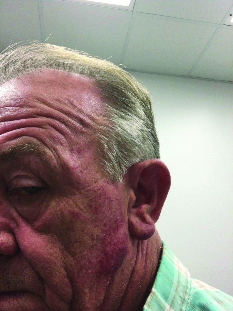 James Lee McCain, 53, suffered multiple contusions resulting from an assault last year.